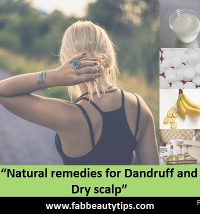 natural dandruff remedies that really works,natural remedies for dandruff,natural remedies for dandruff and dry scalp,natural ways to treat dandruff