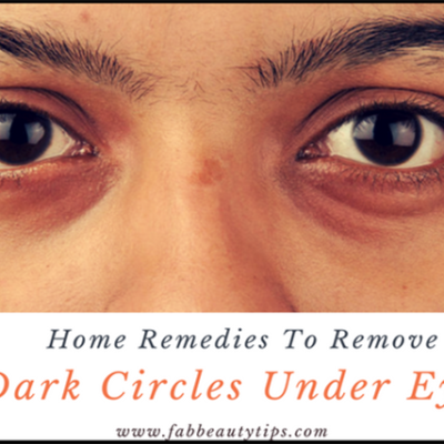 28 Best Home Remedies To Remove Dark Circles Under Eyes Permanently