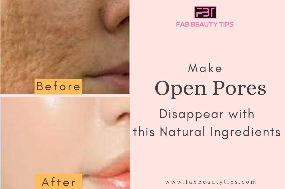 home remedies for large pores, home remedies for open pores, how to remove pores from face