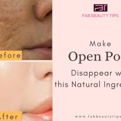 How to Remove Open Pores from face – Magical Remedy