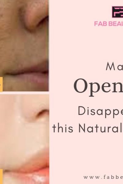 home remedies for large pores, home remedies for open pores, how to remove pores from face