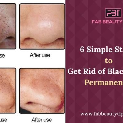 Try this Easy Six Steps to Get Rid of Blackheads