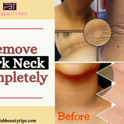 Get Rid of Dark Neck in a week