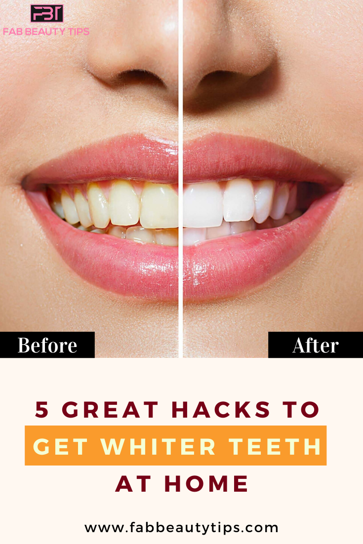 Great Hacks to get whiter teeth at home