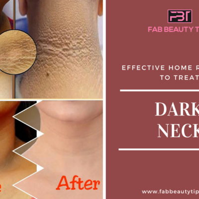 How To Get Rid Of Dark Neck: 12 Effective Home Remedies