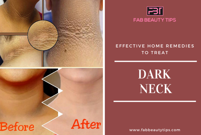 best remedy for dark neck, home remedies for dark neck, home remedies to get rid of dark neck, how to clean dirt on neck, how to get rid of dark neck home remedies, how to get rid of dark neck instantly, how to lighten black neck, how to lighten my dark neck