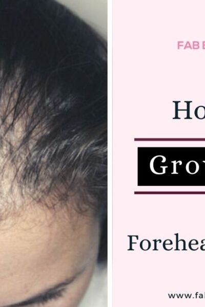 forehead hair growth, forehead hair growth tips and remedies, grow hair on forehead, hair growth home remedies for forehead, how to grow hair on forehead