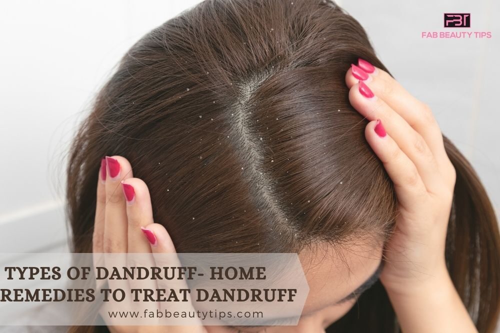 different kinds of dandruff, different types of dandruff on scalp, flaky scalp dry hair, flaky scalp oily hair, types of dandruff and treatment