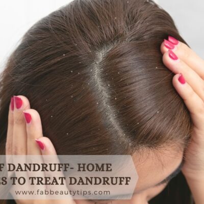  Types of dandruff- home remedies to treat dandruff