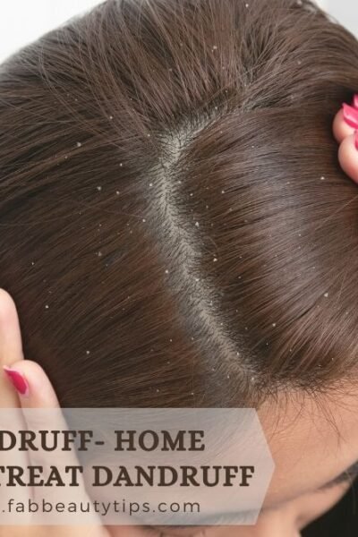 different kinds of dandruff, different types of dandruff on scalp, flaky scalp dry hair, flaky scalp oily hair, types of dandruff and treatment