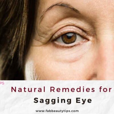 Natural Remedies for Sagging Eyes